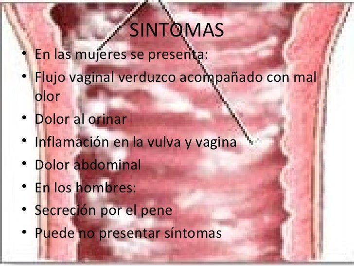 Vulva En La Enfermedades Venerias Vulva En La Enfermedades Venerias